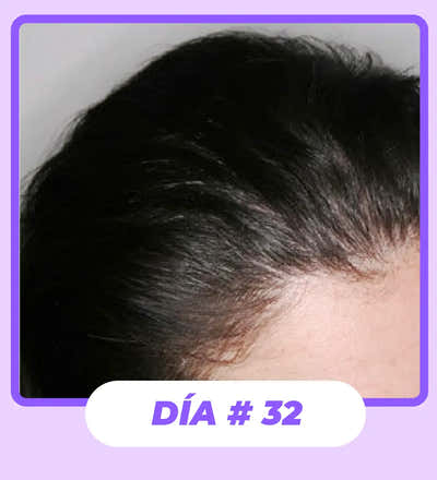 After Image
