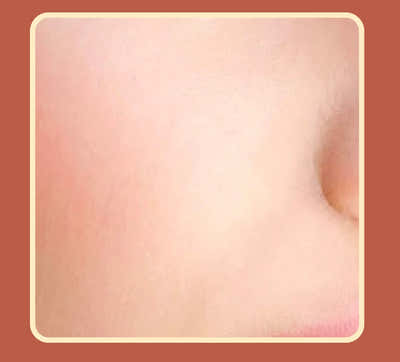 After Image