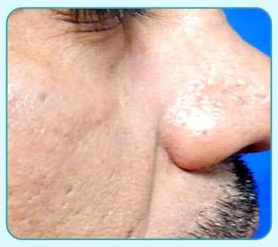 After Image