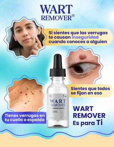 Imagen del carrusel