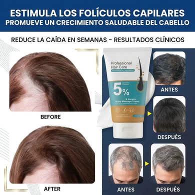 Imagen del carrusel