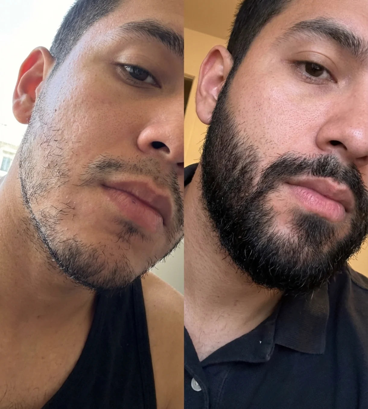 BALSAMO CRECE BARBA APOLO [PV1-WHATSAPP-TRENDSHOP]