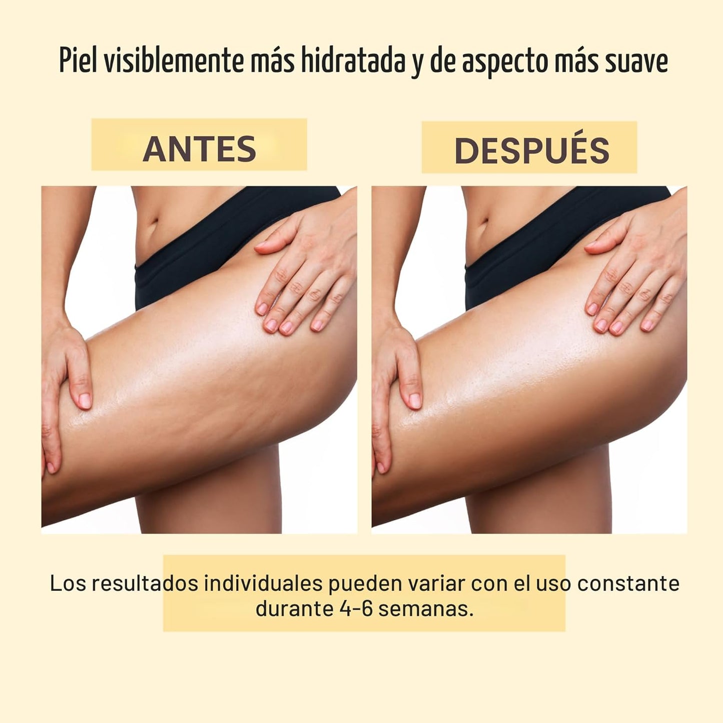 ACEITE ANTI CELULLITIS [PV1-WHATSAPP-TRENDSHOP]