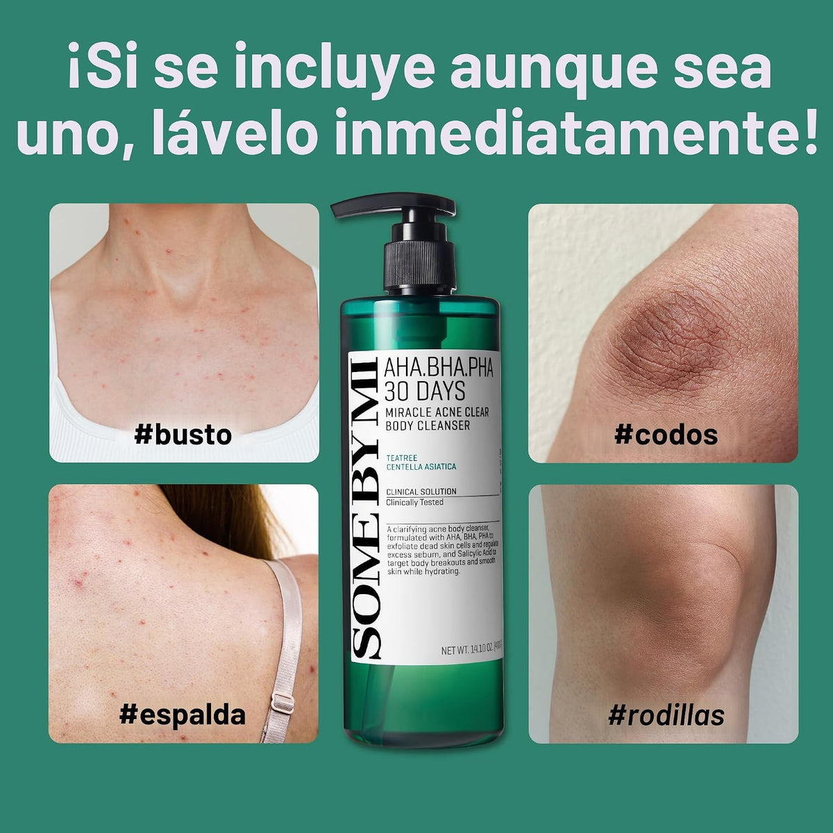 GEL DE BAÑO ANTI ACNE [PV1-WHATSAPP-TRENDSHOP]