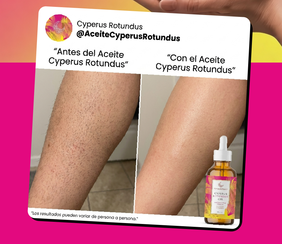 ACEITE CYPERUS ROTUNDUS [PV1-WHATSAPP-TRENDSHOP]