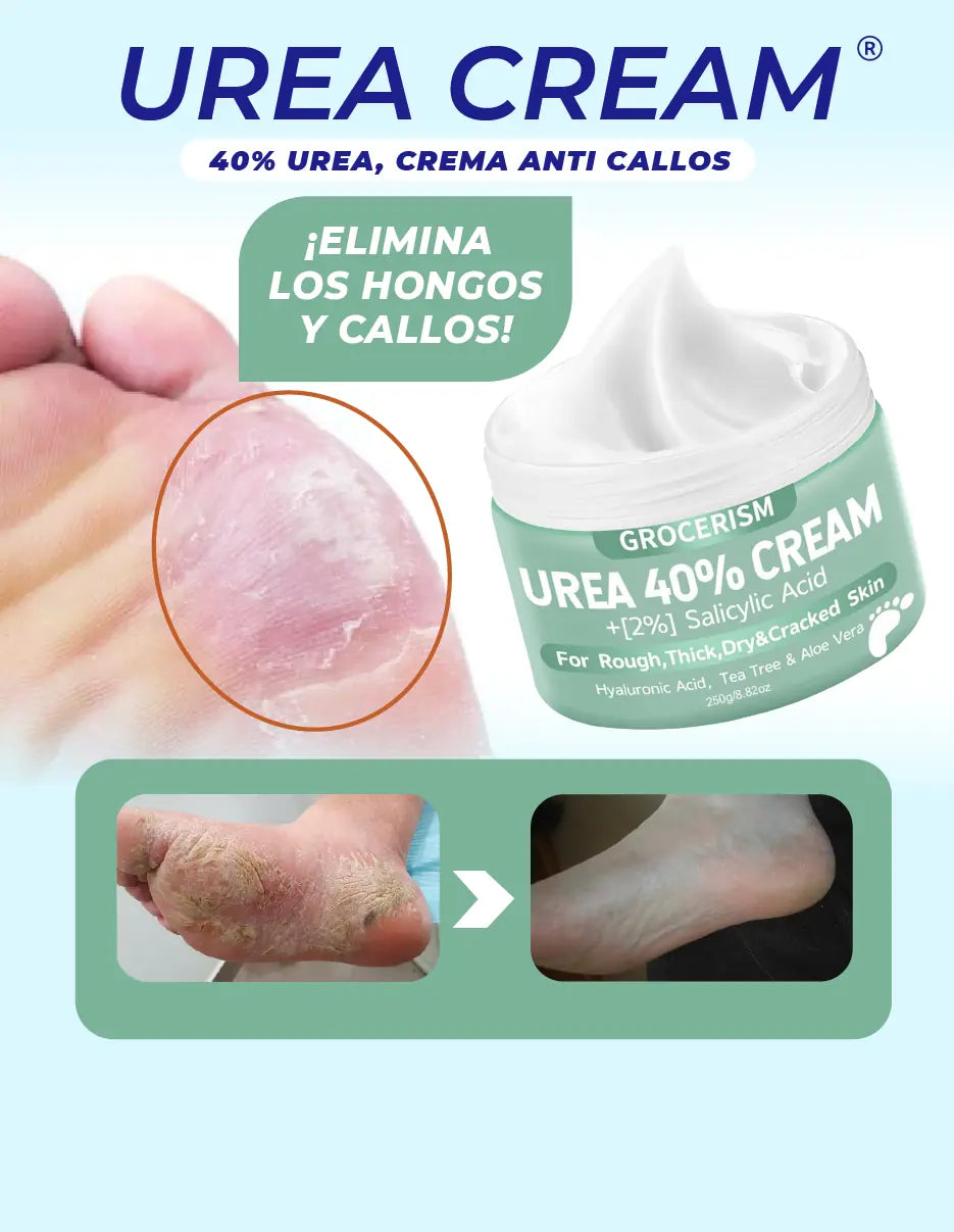CREMA UREA 40% [PV1-2X1-WHATSAPP-TRENDSHOP]