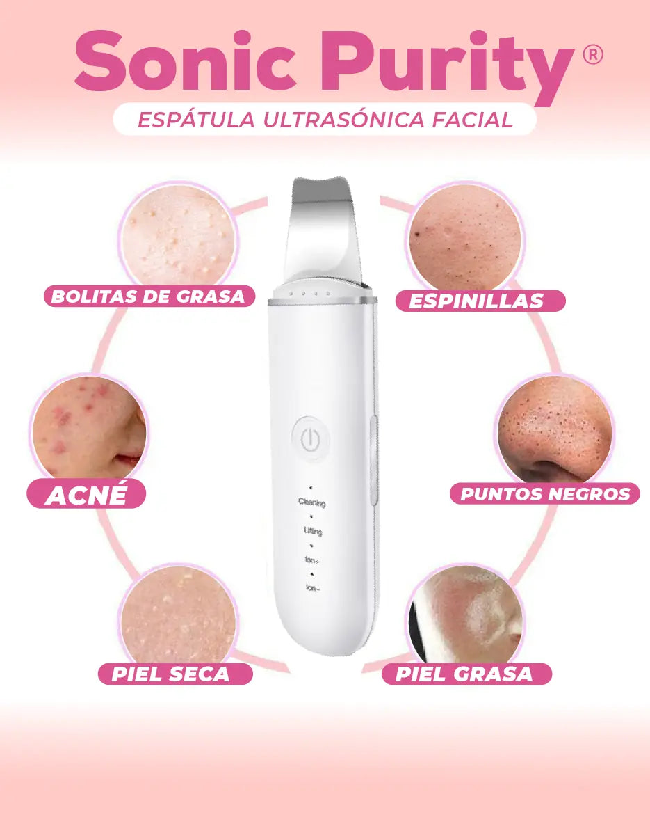 ESPATULA LIMPIADOR FACIAL ULTRASONICO [PV1-WHATSAPP-TRENDSHOP]