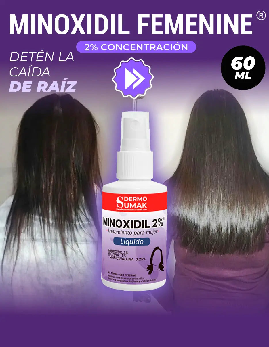 MINOXIDIL FEMENINE [PV1-META-TRENDSHOP]