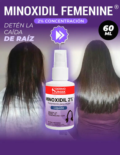 Imagen del carrusel