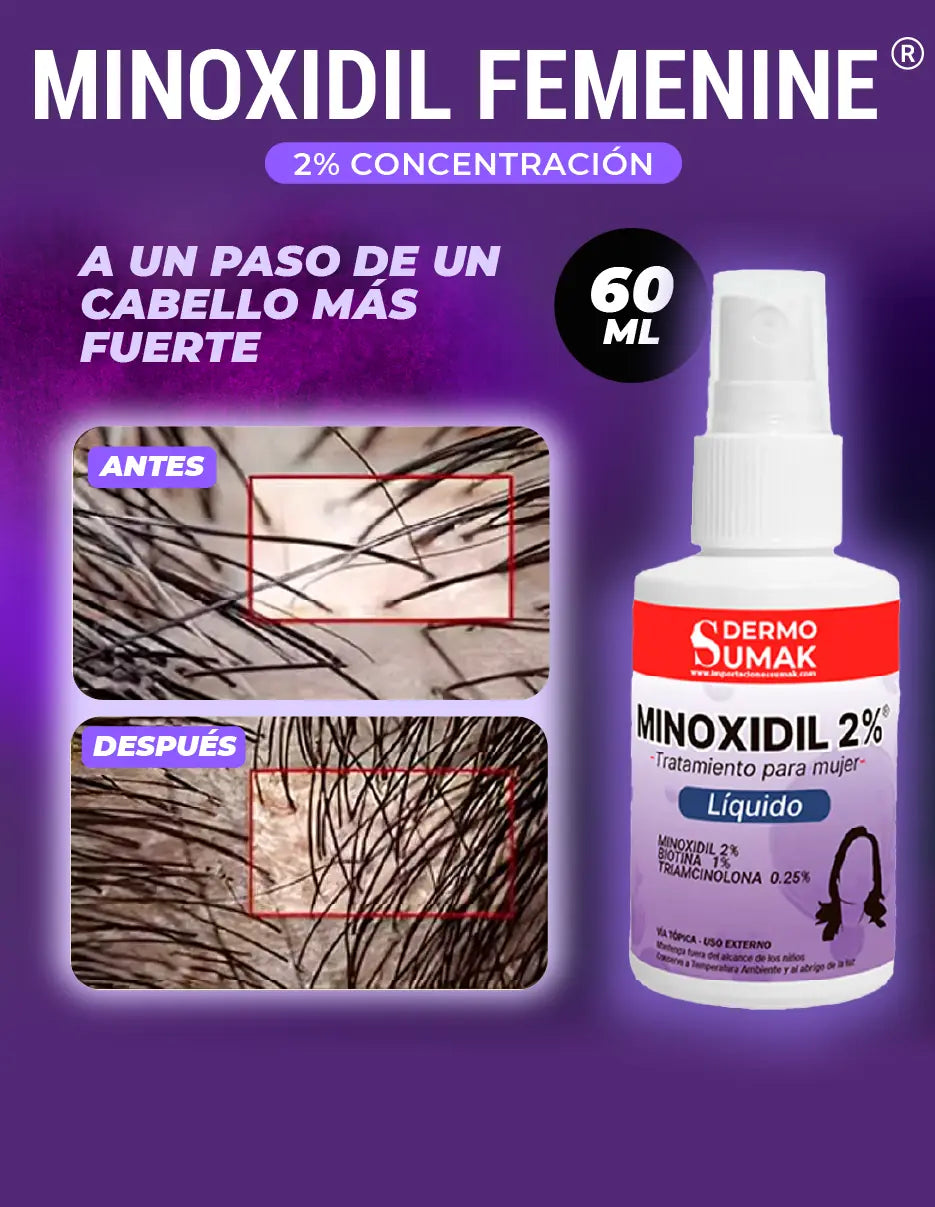 MINOXIDIL FEMENINE [PV1-META-TRENDSHOP]