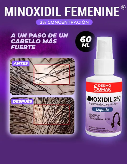 MINOXIDIL FEMENINE [PV1-META-TRENDSHOP]