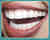 After Image