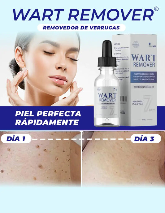 REMOVEDOR DE VERRUGAS WART REMOVER [PV1-META-TRENDSHOP]