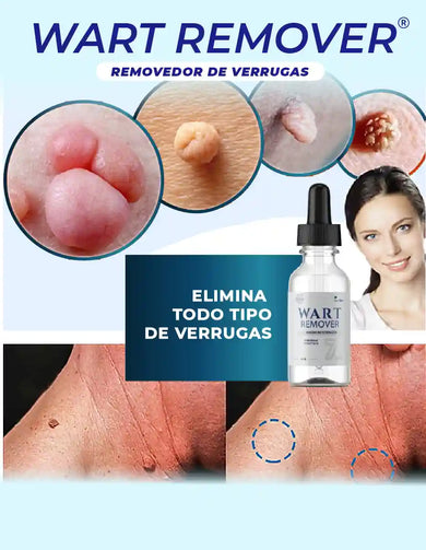 Imagen del carrusel