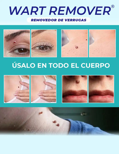 Imagen del carrusel