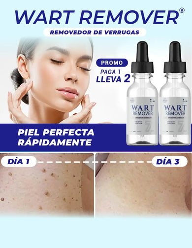 Imagen del carrusel