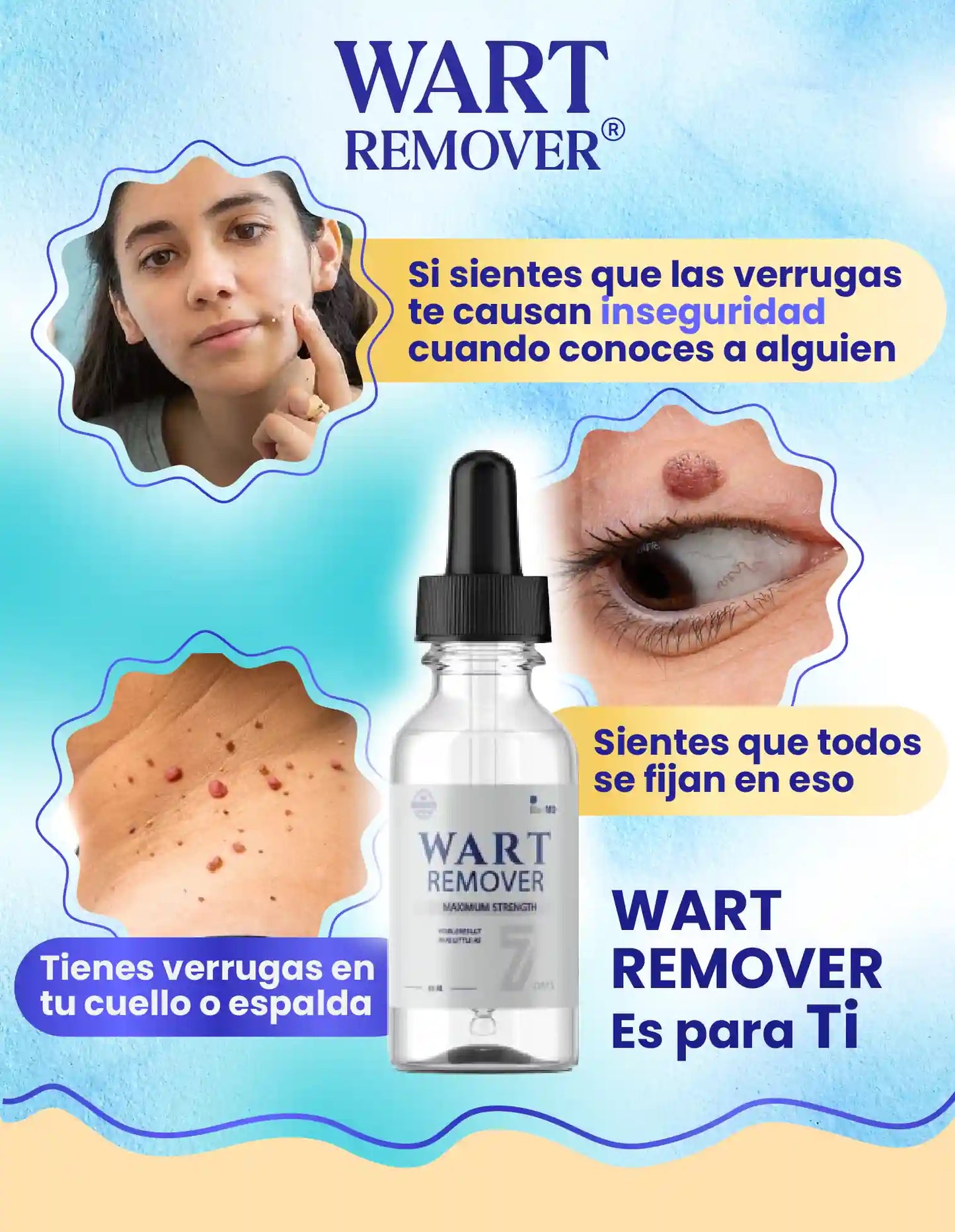 REMOVEDOR DE VERRUGAS WART REMOVER [PV2-META-TRENDSHOP]