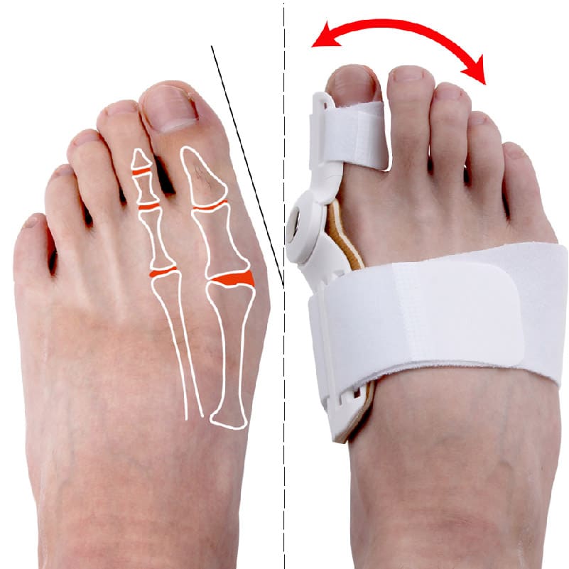 CORRECTOR DE JUANETES [PV1-WHATSAPP-TRENDSHOP]