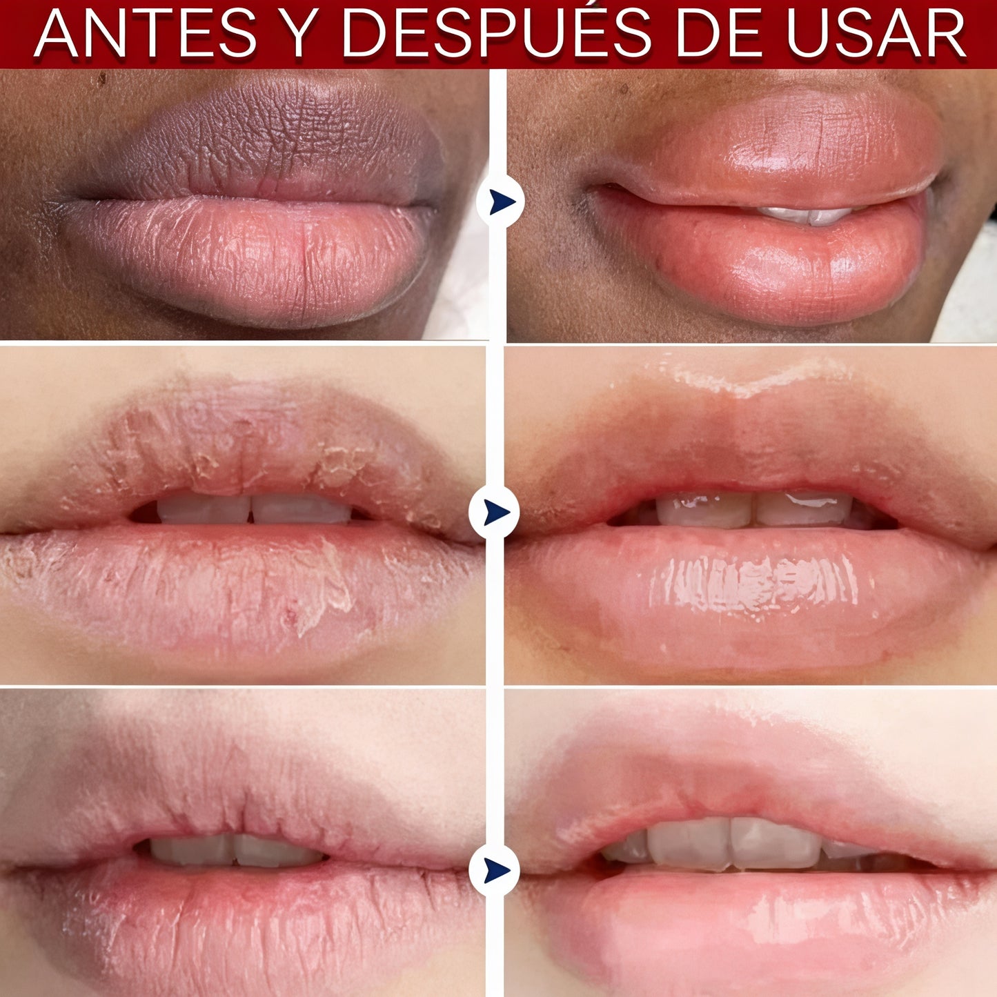 SERUM LABIAL [PV1-WHATSAPP-TRENDSHOP]