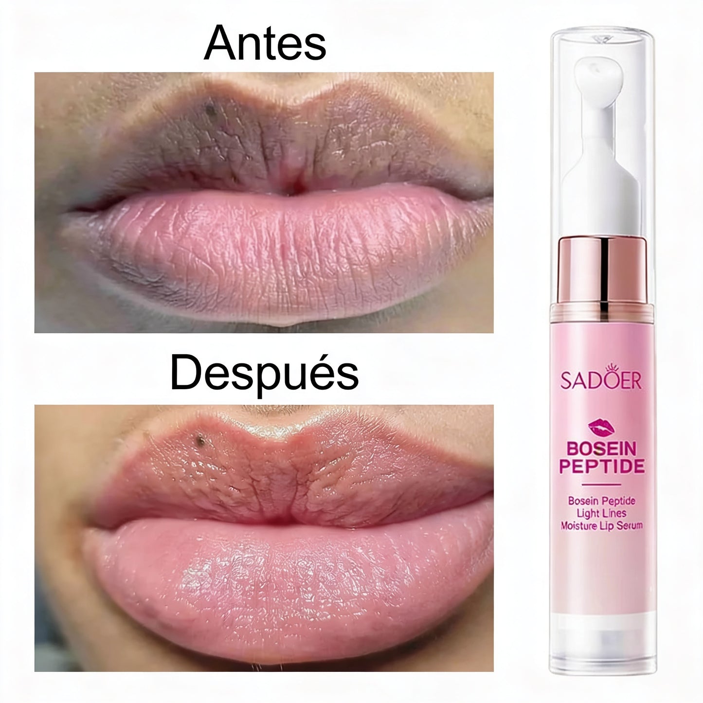 SERUM LABIAL [PV1-WHATSAPP-TRENDSHOP]