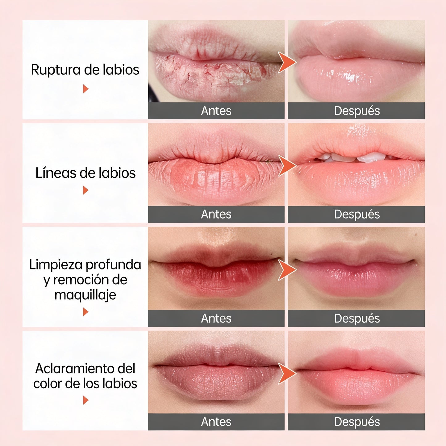 SERUM LABIAL [PV1-WHATSAPP-TRENDSHOP]